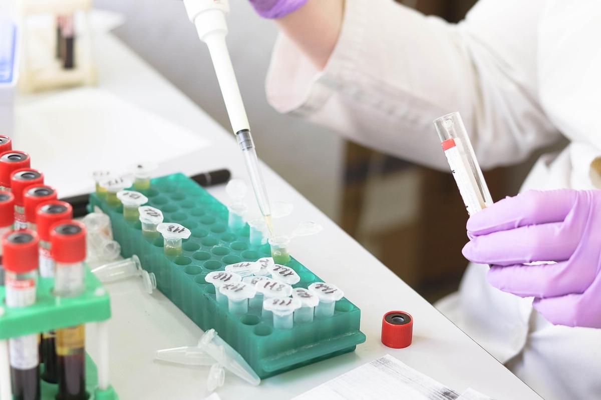 Phlebotomist preparing a blood sample vial for HbA1c testing